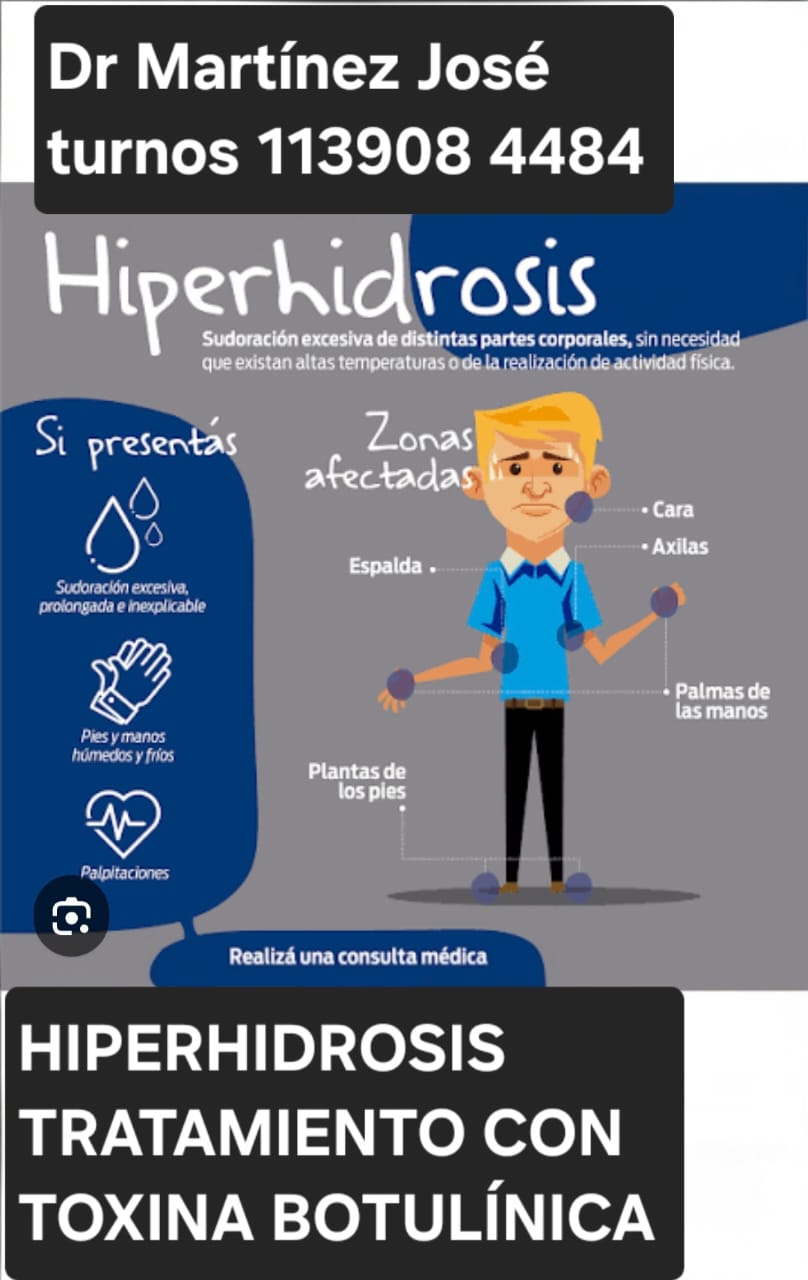 Tratamiento Medico hiperhidrosis o *SUDORACIÓN EXCESIVA* Berazategui, Quilmes, Florencio * Tratamiento toxina botulínica* en axila deja de transpirar*